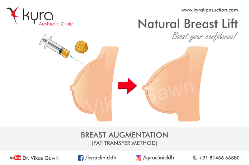 Fat Transfer Breast Augmentation India